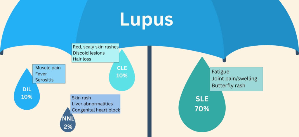 Potential symptoms of lupus, signs of lupus nephritis