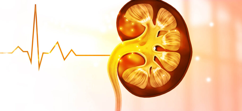 Kidney cross section, how to lower creatinine levels naturally